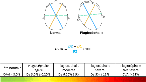 image-mesures-plagio image-mesures-plagio
